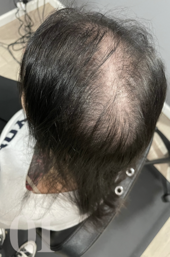 Step 1: Consultation & Assessment